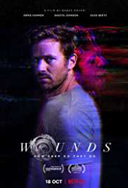 Wounds 2019 Dual Audio Hindi 480p 300MB HDHub4u